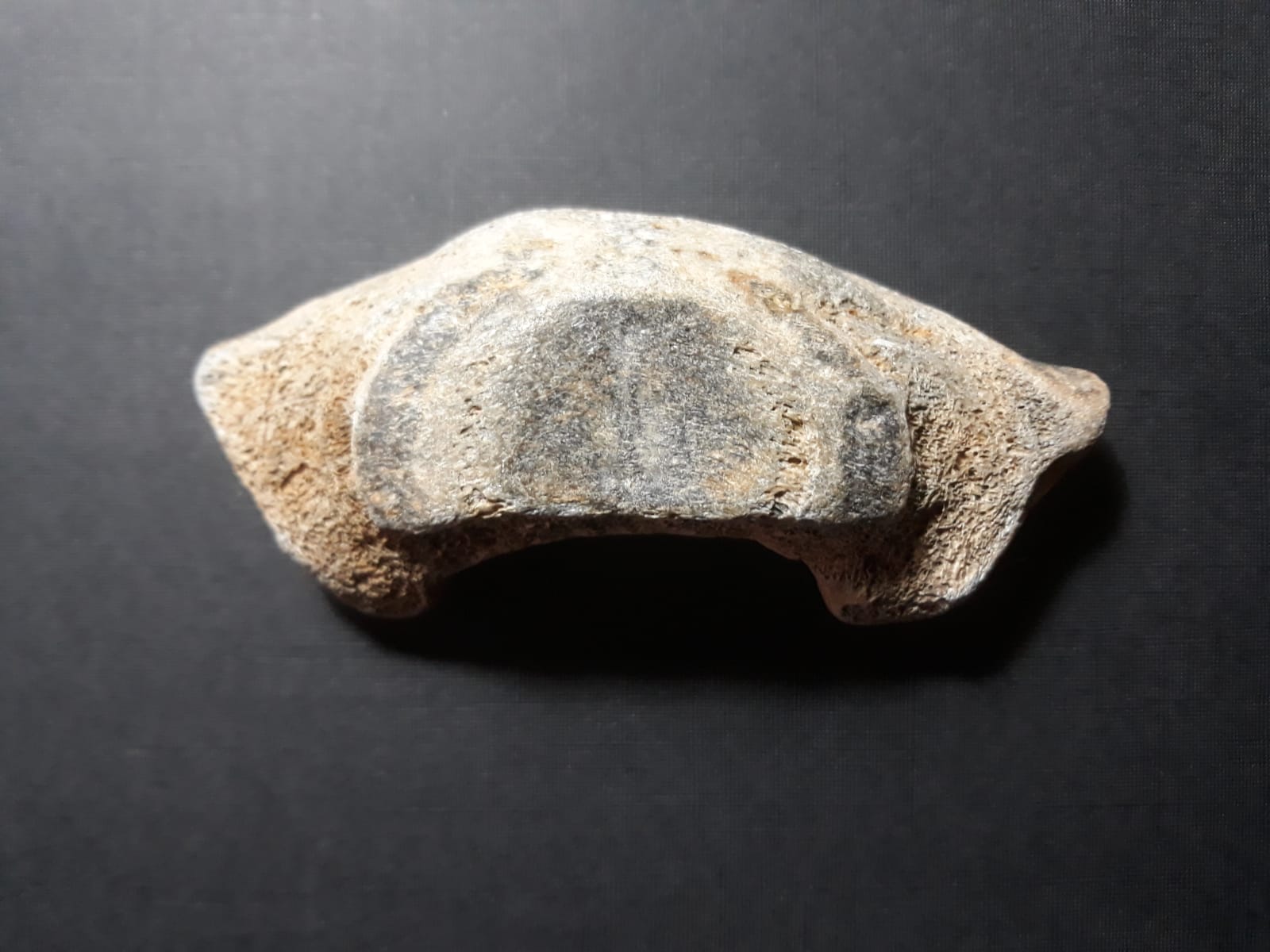 Vertebra?